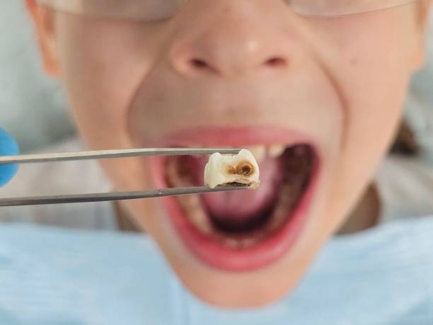 Best Pediatric Emergency Dentist in Strasburg, VA